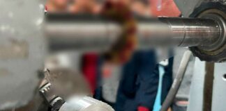 Alumno podría perder el brazo tras accidente en bachiller de Tepeaca Alumno