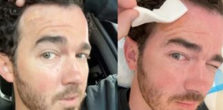 Kevin Jonas revela que le detectaron cáncer de piel