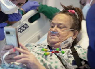 Muere paciente que recibió trasplante de riñón de cerdo