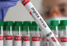 China aprueba comercialización de su primer test para detectar Mpox