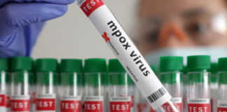China aprueba comercialización de su primer test para detectar Mpox