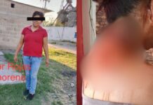 Mujer le tira agua hirviendo a su compañera en restaurante de Izúcar