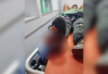 Joven pierde pie por explosión de cohetón en Chignautla