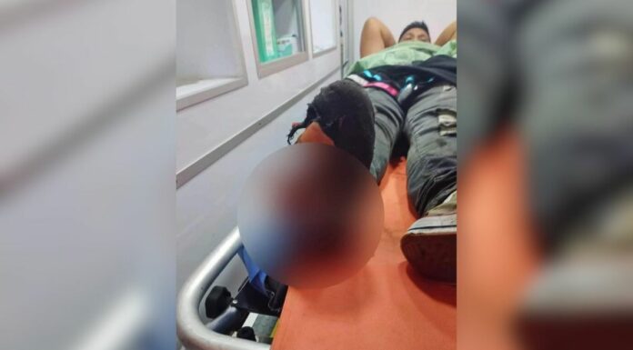 Joven pierde pie por explosión de cohetón en Chignautla