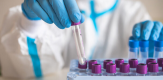 OMS autoriza uso de emergencia de prueba diagnóstico de mpox