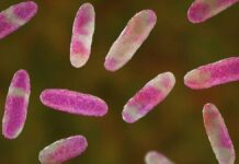 Casos de Klebsiella oxytoca en Edomex, bajo control: Salud