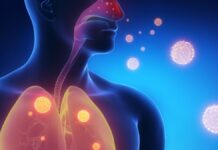 Suman 150 casos de metapneumovirus en Sinaloa