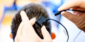 IA logra que víctima de derrame cerebral “hable”