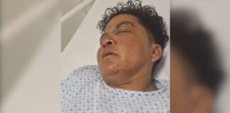 Golpean a la activista Laura Franco en Izúcar