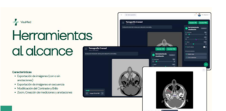 IBERO Puebla innova en estudios de imagenología