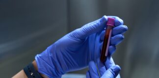 Descubren nuevo grupo sanguíneo; sólo una mujer lo tiene