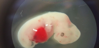 Cultivan corazones humanos en embriones de cerdo por primera vez