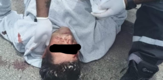 Hombre herido con machete tras ser confundido en Texmelucan