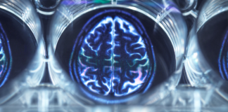 Científicos localizan tumor cerebral gracias a chip