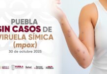 Descartan presencia de viruela símica en escuelas de Puebla