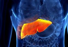 Se estima que 1 de cada 2 mexicanos padece hígado graso