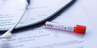 99% de los casos de VIH en Puebla son por transmisión sexual