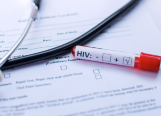 99% de los casos de VIH en Puebla son por transmisión sexual