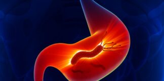 7 de cada 10 mexicanos porta una bacteria que puede derivar en cáncer