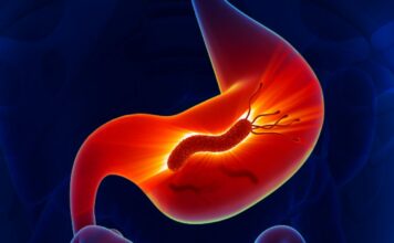 7 de cada 10 mexicanos porta una bacteria que puede derivar en cáncer