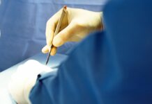 Organizan “tandas” para pagar cirugías estéticas en Guanajuato