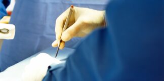 Organizan “tandas” para pagar cirugías estéticas en Guanajuato