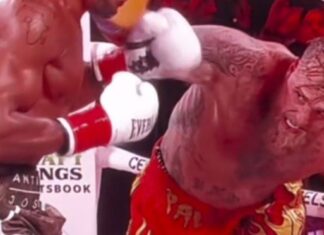 Jake Paul sufre doble fractura de mandíbula en derrota ante Anthony Joshua