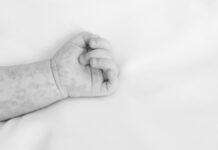 Fallece bebé por complicaciones de sarampión en Tlaxcala