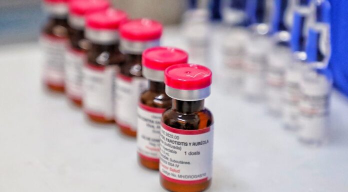 Bebé fallecido por sarampión no era residente de Puebla, aclara Salud