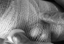 Niño de cuatro años resulta herido tras ataque de pitbull en Acatlán