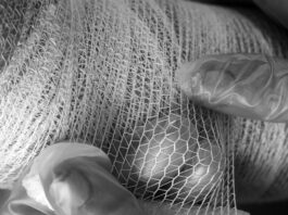 Niño de cuatro años resulta herido tras ataque de pitbull en Acatlán