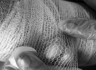 Niño de cuatro años resulta herido tras ataque de pitbull en Acatlán