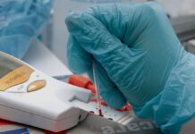 ISSSTEP sólo atenderá urgencias y hospitalización el lunes 16 de marzo