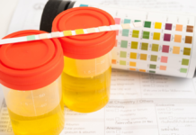 Proponen exámenes toxicológicos obligatorios a candidatos en Puebla