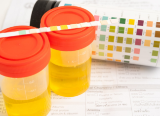 Proponen exámenes toxicológicos obligatorios a candidatos en Puebla