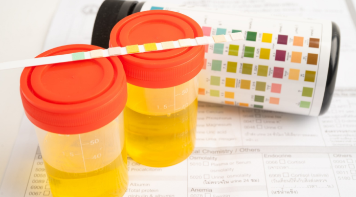 Proponen exámenes toxicológicos obligatorios a candidatos en Puebla