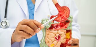 Advierten riesgos gastrointestinales por llegada de la temporada de calor