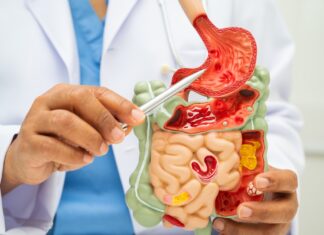 Advierten riesgos gastrointestinales por llegada de la temporada de calor