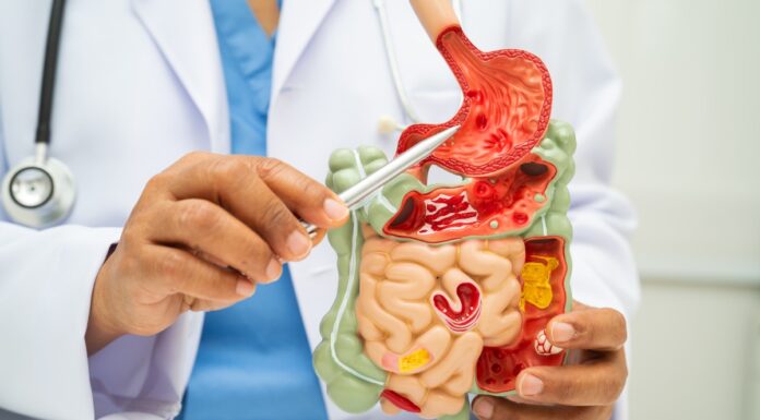 Advierten riesgos gastrointestinales por llegada de la temporada de calor