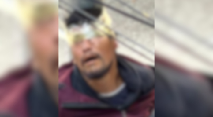 Vecinos de Loma Bella logran someter a presunto ladrón