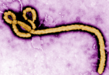 Investigan dos posibles contagios de ébola en Brasil e Italia