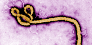 Investigan dos posibles contagios de ébola en Brasil e Italia