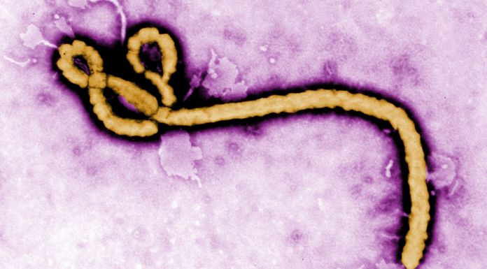 Investigan dos posibles contagios de ébola en Brasil e Italia
