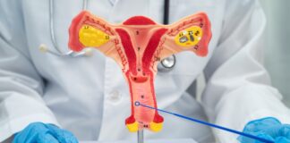 Cáncer de ovario: detectarlo a tiempo puede salvar vidas