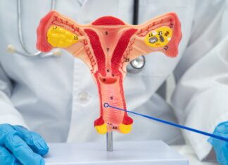 Cáncer de ovario: detectarlo a tiempo puede salvar vidas