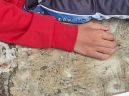 Víctima de bullying en Atlixco termina hospitalizado