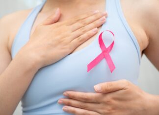 Desarrollan proyecto de IA para personalizar tratamientos por cáncer de mama