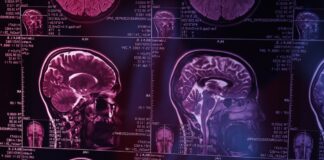 ¿Qué es lo primero que olvida una persona con Alzheimer?