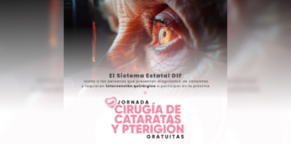 SEDIF invita a jornada gratuita de cirugías de cataratas y pterigión