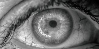 Derrame ocular podría ser señal de hipertensión o diabetes